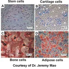 Stem cells, cartilage cells, bone cells and adipose cells under a microscope