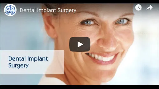 Dental Implants Video Picture